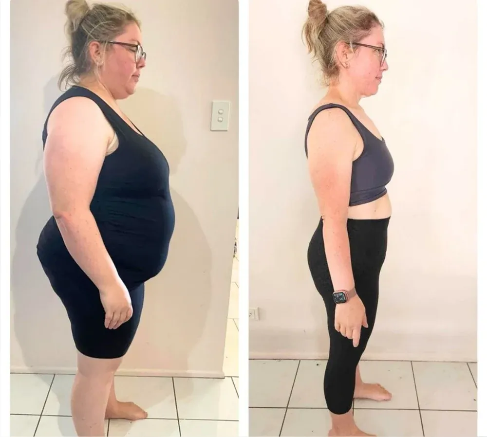 Before and after client results